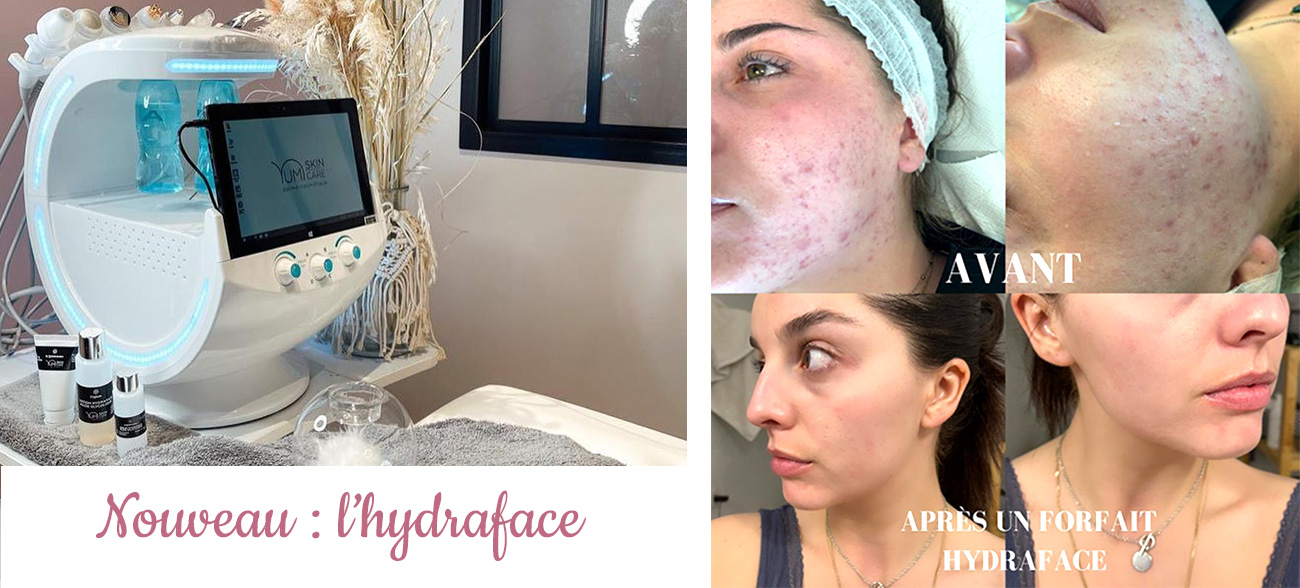 Hydraface : un soin visage complet purifiant et hydratant