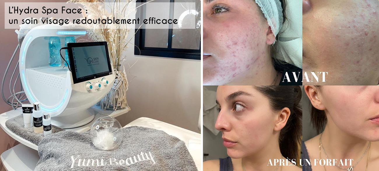 Hydra Spa Face : un soin visage complet purifiant et hydratant